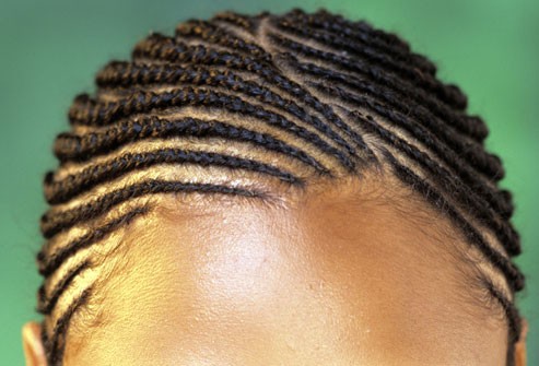 这不是传说:上图这样的玉米垄发型或者扎得太紧的马尾辫会对头皮造成