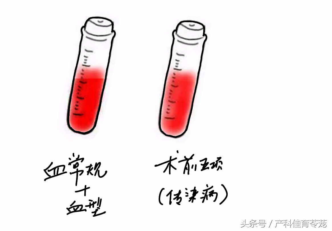 上环图解宫内节育器放置流程