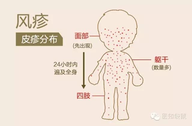 水痘、手足口病、麻疹、风疹，这些传染病你能分得清么？
