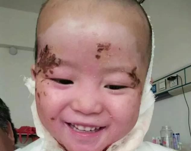 紧急求救！潍坊3岁女孩“小王晶”需要您，让爱不再孤单