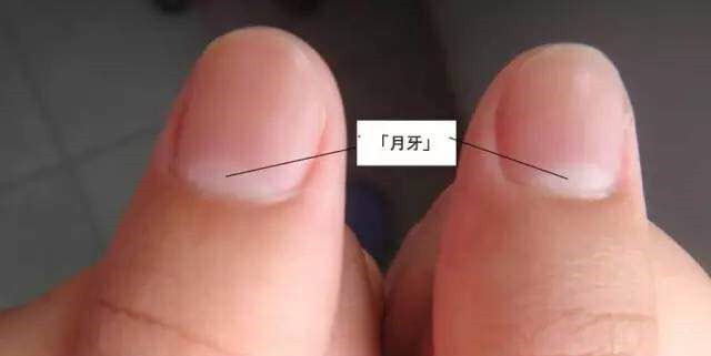 指甲上有“白点”究竟是缺啥？“月牙”大证明你有病？