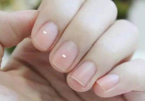 指甲上有“白点”究竟是缺啥？“月牙”大证明你有病？
