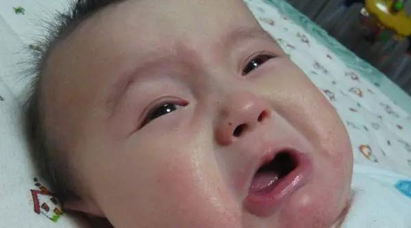 宝宝湿疹不断，大量使用含激素药膏真的可以吗？