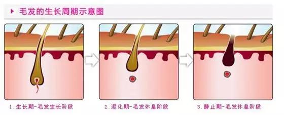 夏天来啦：激光脱毛疼不疼？要做几次？