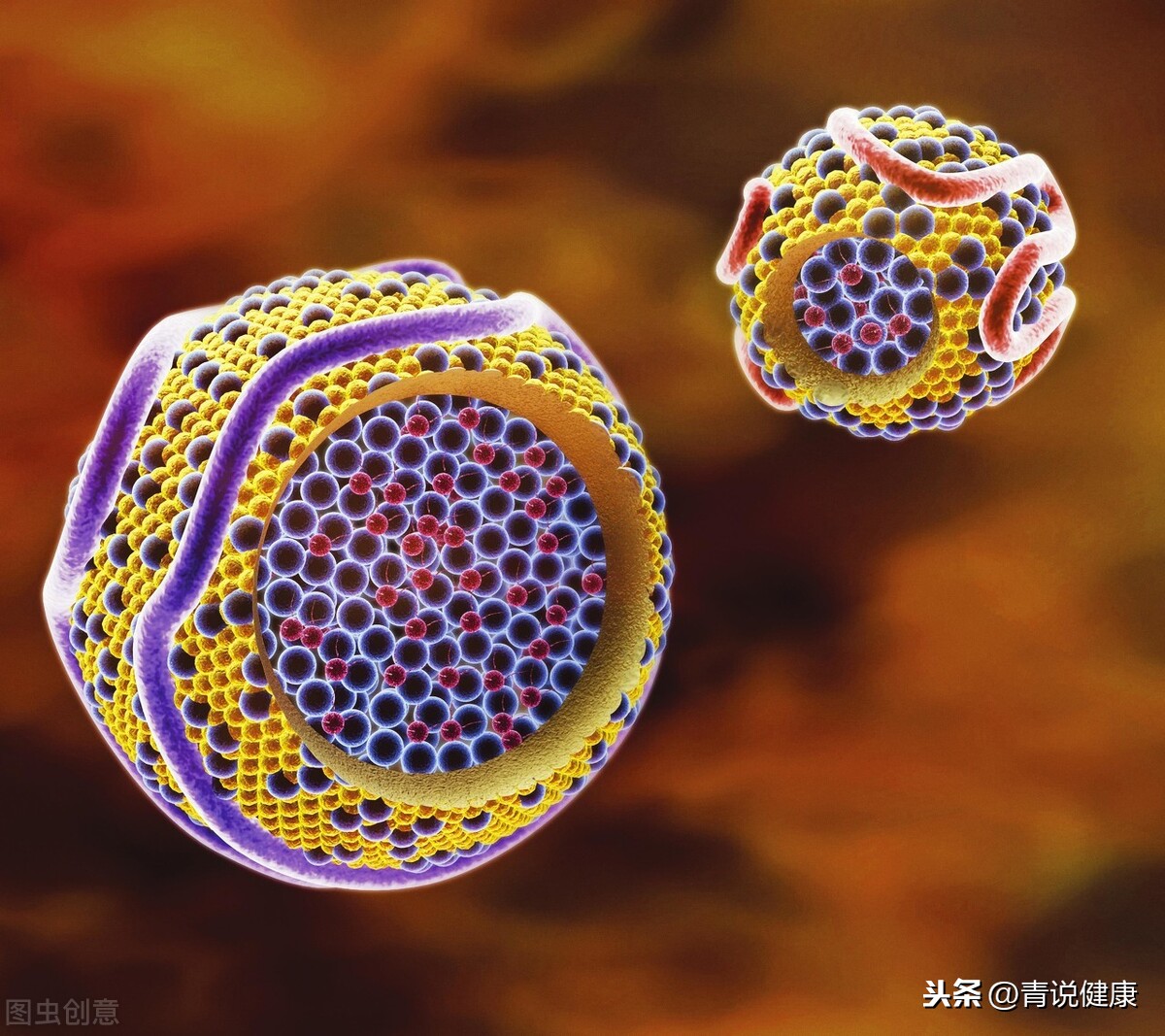 体检低密度脂蛋白高的原因和后果是什么？