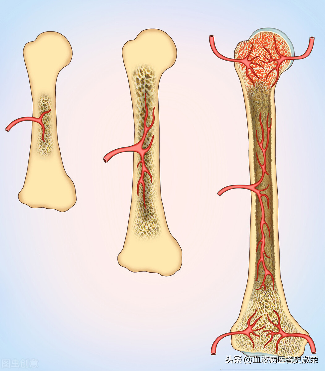 骨髓长什么样图片