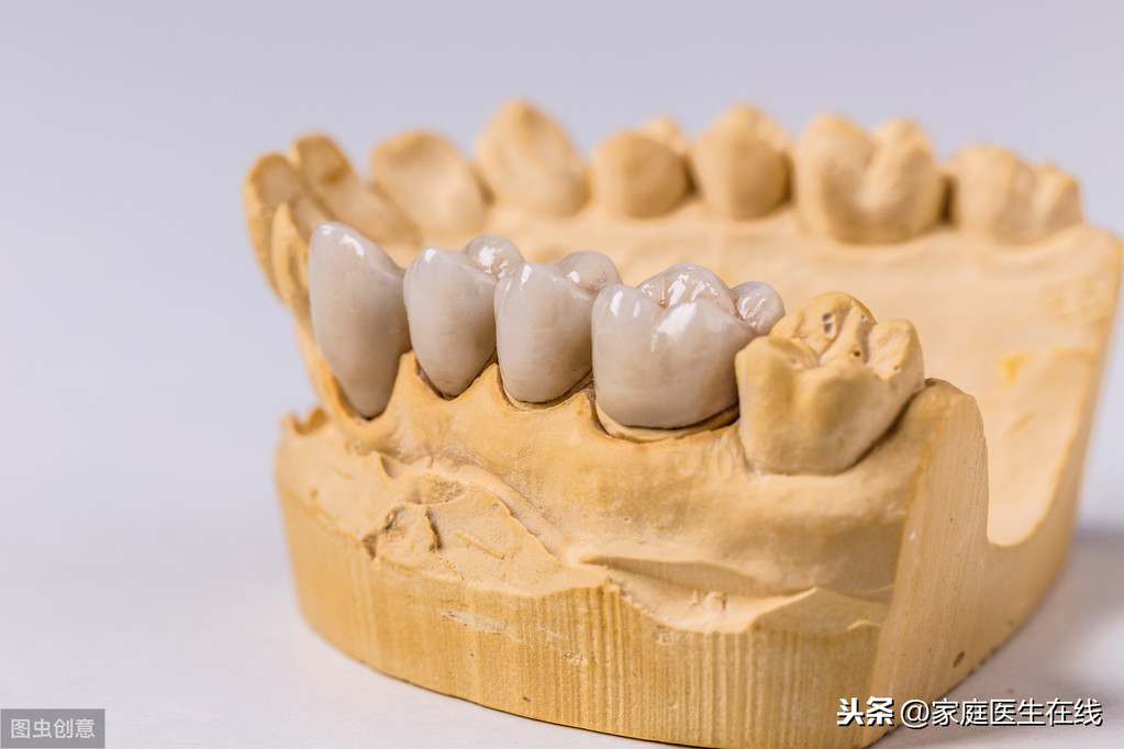 义齿修复后该如何护理？牙科专家建议要做好这三点