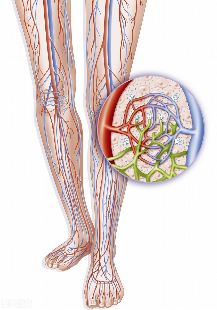 下肢动脉炎图片