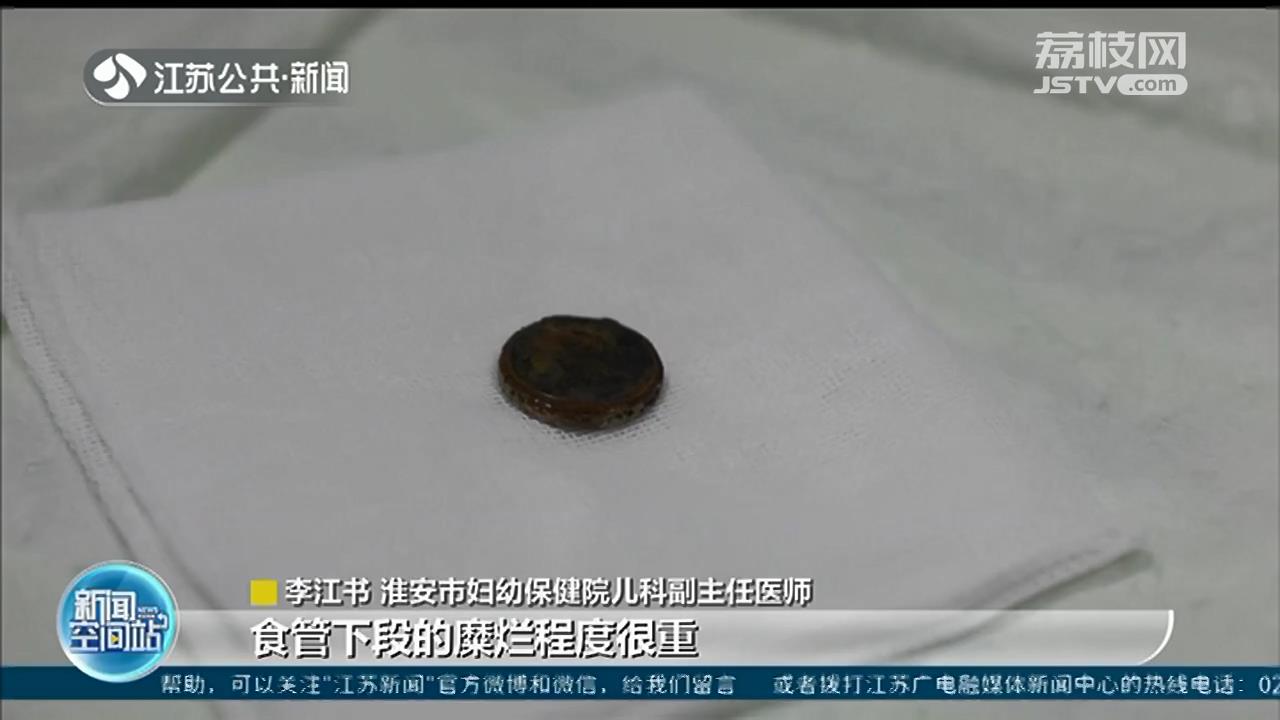 淮安：孩子误吞纽扣电池 仅仅几个小时，食管被电解液腐蚀&ldquo;染&rdquo;黑