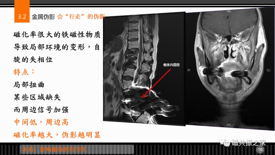 磁共振常见伪影及策略