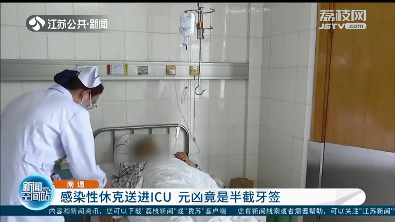 南通大叔感染性休克送进ICU 医生从肝脏里取出半截牙签