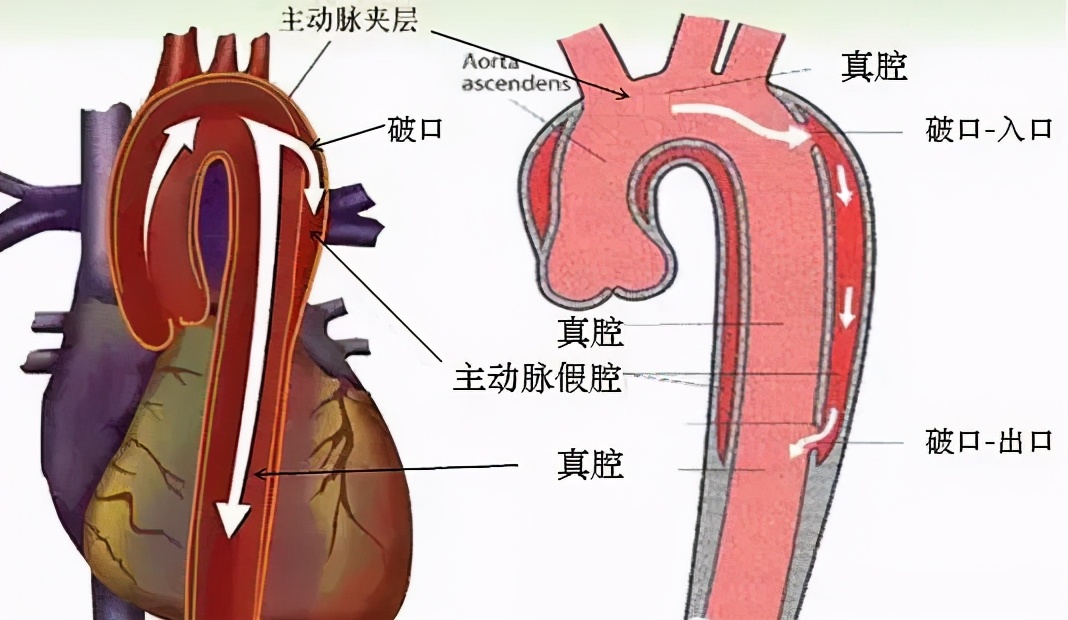 动脉血管分层结构图图片