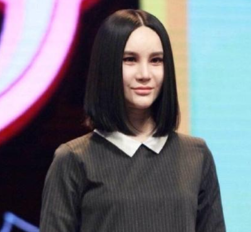 有人整容成功变仙女，也有人整容失败变惊悚，网友：云泥之别