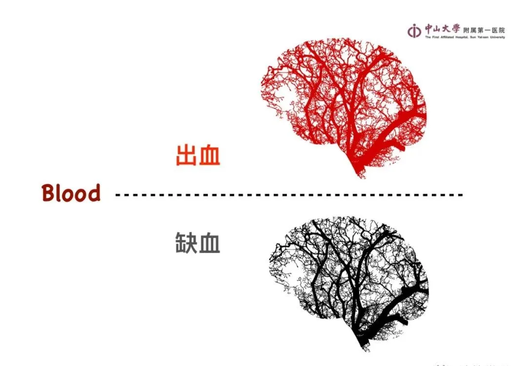 最全影像总结 | 颅内病变 MR、CT 的阅片技巧，太赞了
