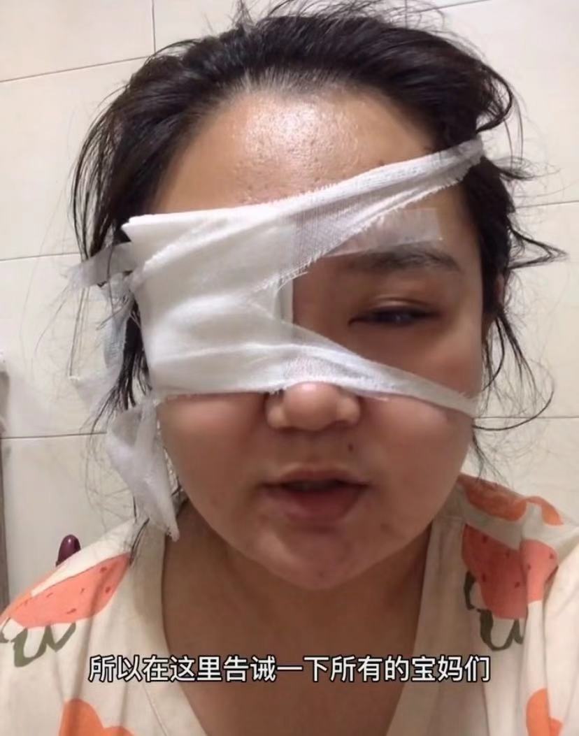 我为你剖腹7层,你却想让我变瞎?生娃后才知孩子“杀伤力”多强