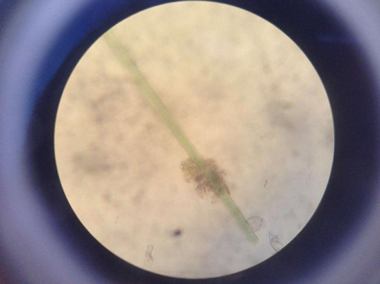 这个是颤藻,在显微镜里面看,他是一直在颤动的,就跟发抖一样鱼腥藻