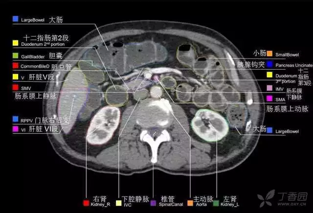 掌握这篇解剖，晋级腹部CT影像诊断高手（精细版）