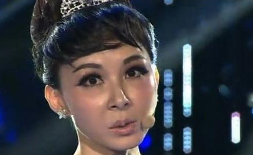 整容毀了多少童年女神，蕭薔王祖賢婁藝瀟，面目全非成毀容