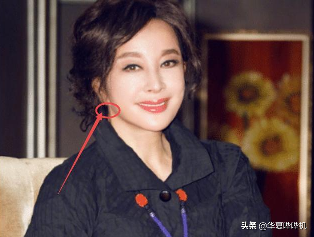 明星大型“翻车”现场，她们是如何整容变毁容