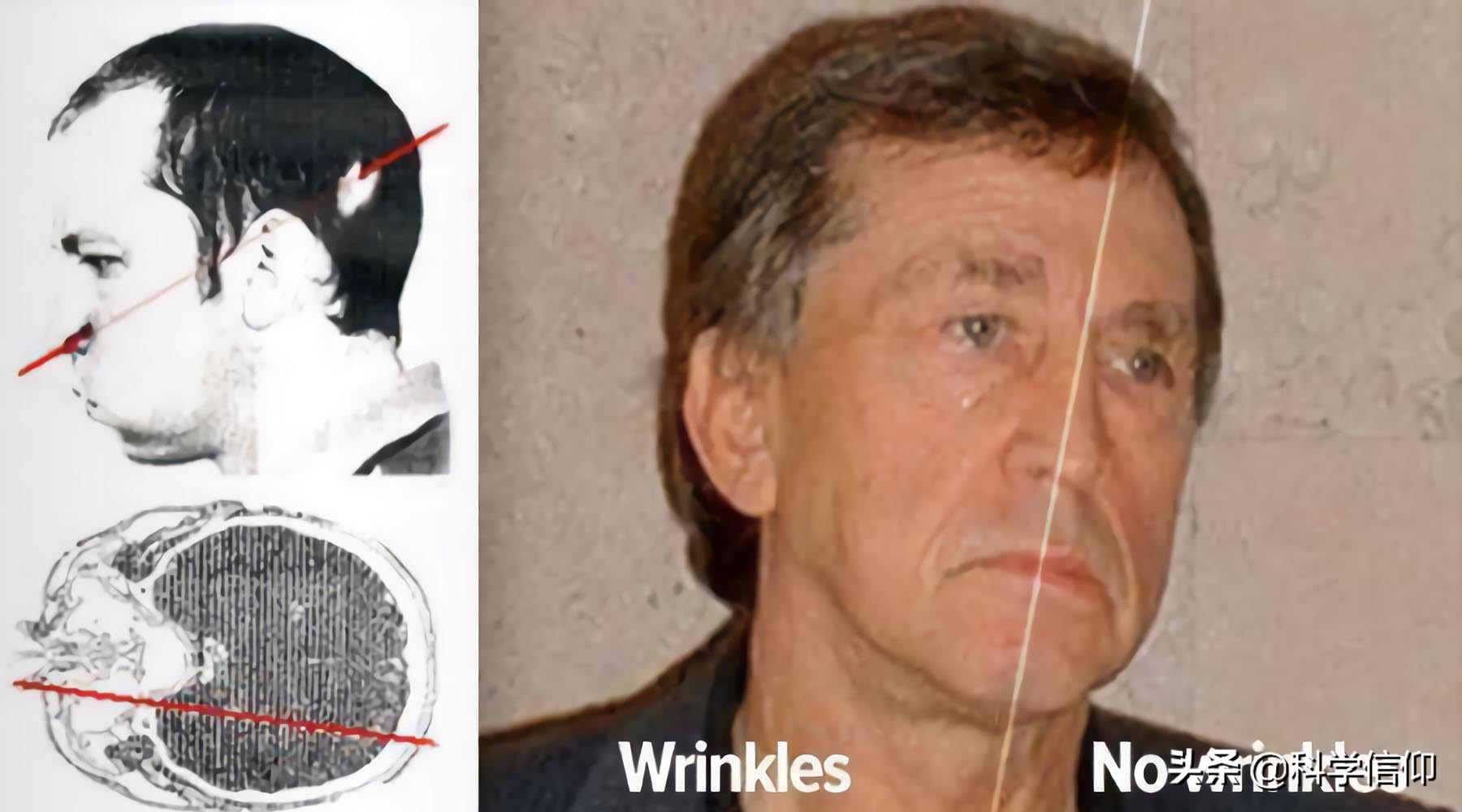 他受到致命輻射量400倍的粒子衝擊，為何還能活下來？因為幸運