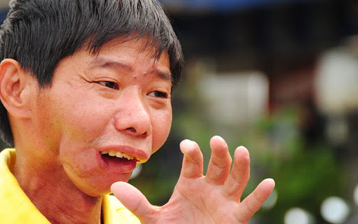 6000万中国人咀嚼的“软性毒品”槟榔，造了一大批“割脸人”