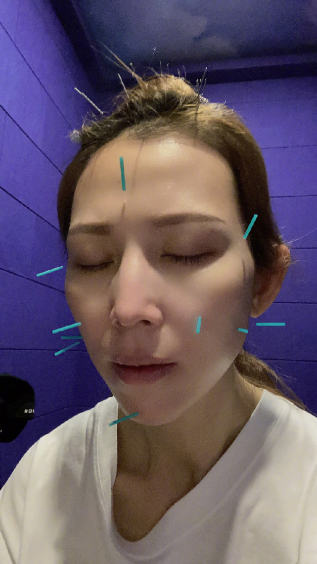 蔡少芬曬懟臉拍鎖骨搶鏡，在線詢問早起嘴腫原因，被侃：張晉親的
