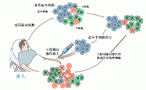 可恶的地中海贫血，是怎么回事？有何治疗新进展？