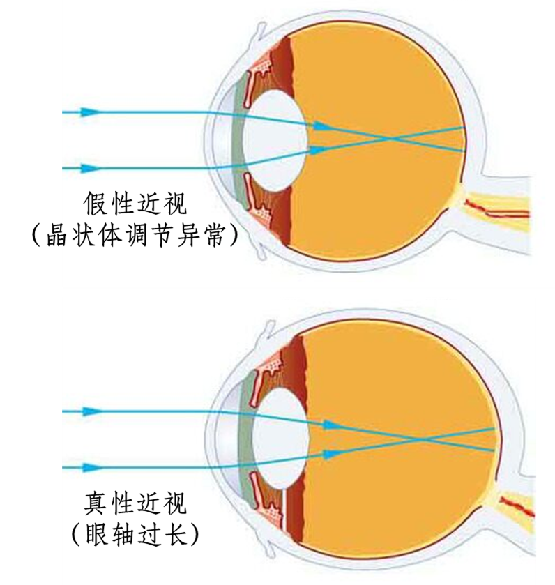 孩子天生都是“远视眼”，“远视储备”应该这样来珍惜