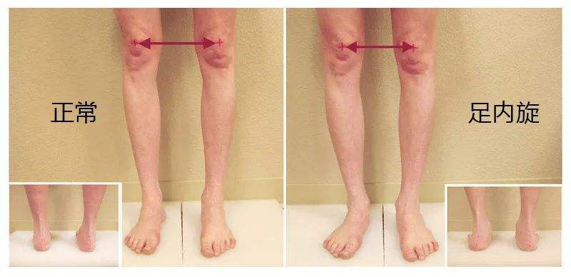 有假胯穿裤子不好看，这几点是造成假胯宽的元凶，你要知道