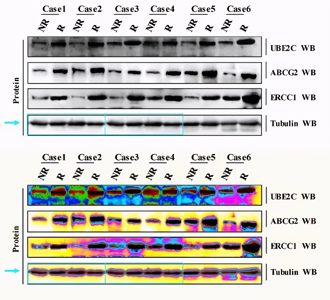 山东滨州医学院附属医院11篇SCI文章"挂榜"PubPeer