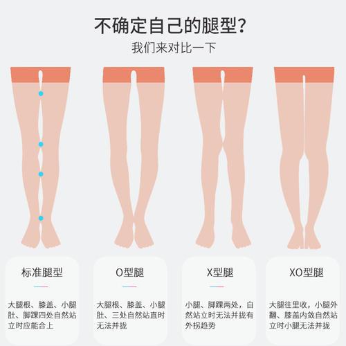 腿型一般分为这4种!选择适合自己的裤子,你也可以是腿精