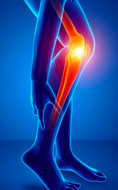 膝關節炎的臨牀表現有哪些 分享中醫治療的3個步驟 西安市中醫醫院 Mdeditor