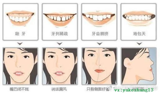 牙齿矫正的需要多长时间？