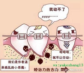 牙齿矫正的需要多长时间？