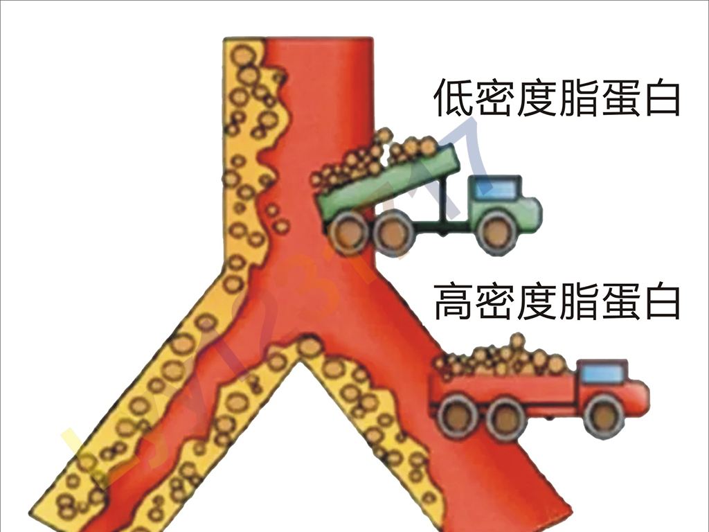 多久查一次血脂好？