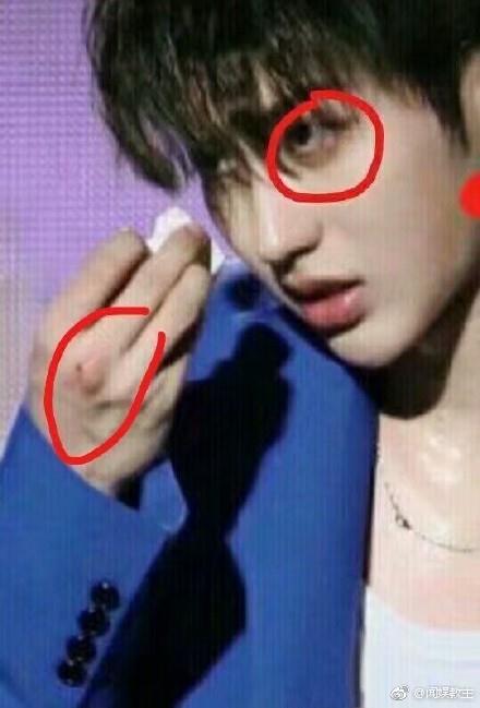 蔡徐坤被激光笔照伤,粉丝应援蔡徐坤nmsl?