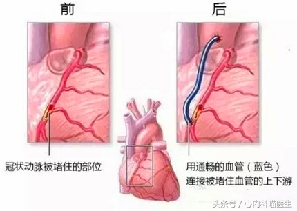 心脏病康复保养至关重要，做好医疗保健的4S店