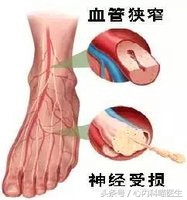 心臟病康復保養至關重要，做好醫療保健的4S店