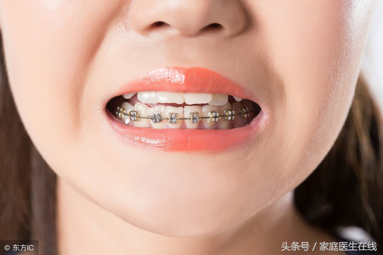 牙齿矫正靠谱吗？这三种方法，还你一口整齐牙齿