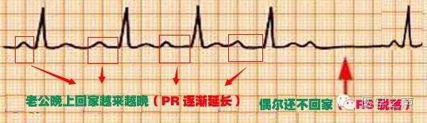这么教你看心电图，还有什么理由看不懂？