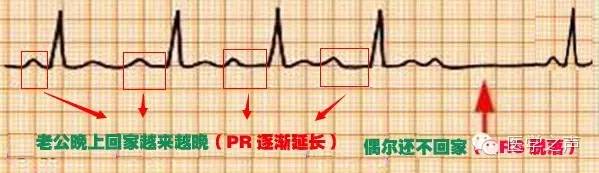 这么教你看心电图，还有什么理由看不懂？