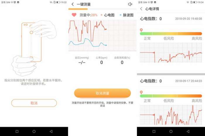 国产手机能做心电图还有24小时医生陪伴：私人医生手机体验