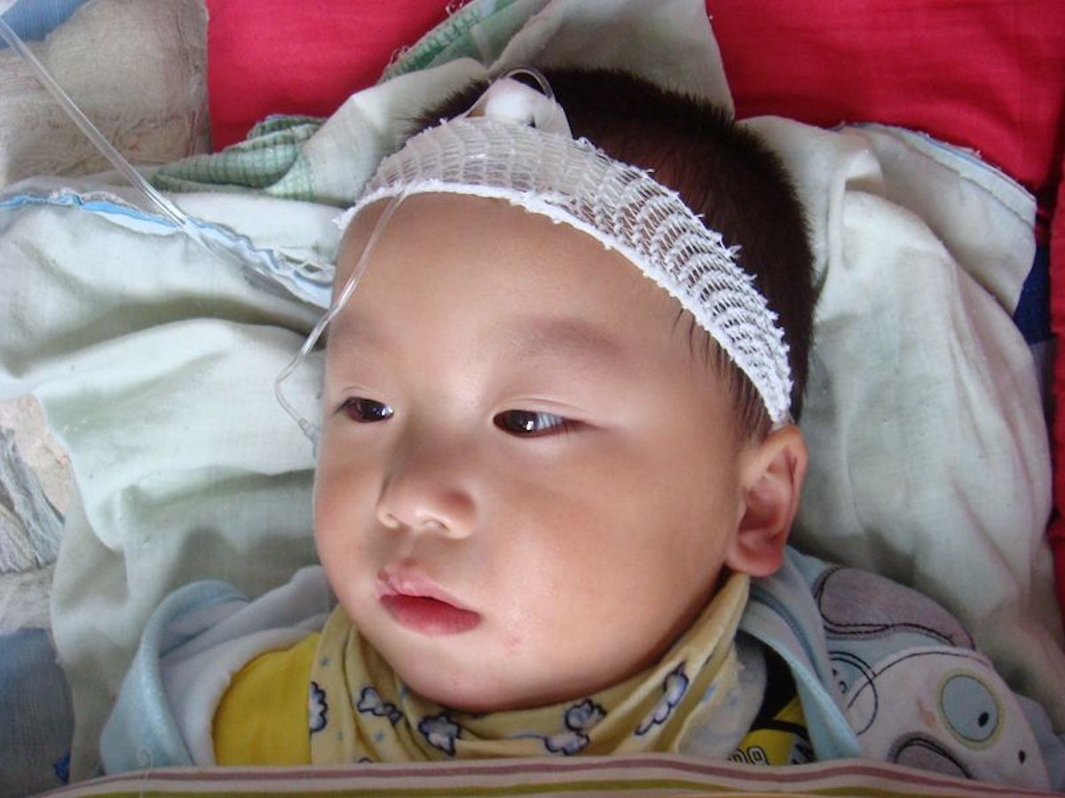 2个月婴儿缺锌的表现（宝宝缺锌会有什么表现）-幼儿百科-魔术铺
