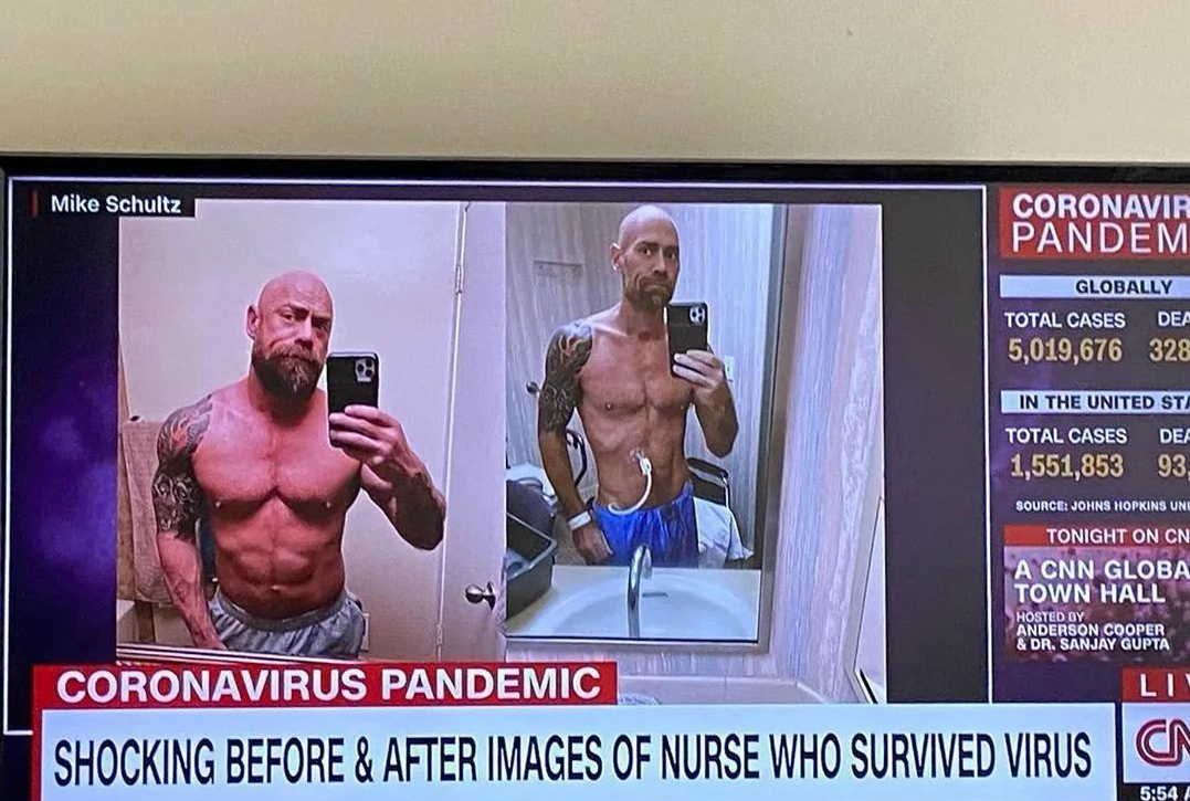 美國43歲肌肉男護士感染新冠後，瘦成「排骨精」，2個月老10歲