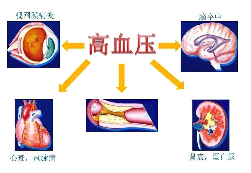 高血压3年没治就造成了心肾损害？发现高血压都该查些什么？