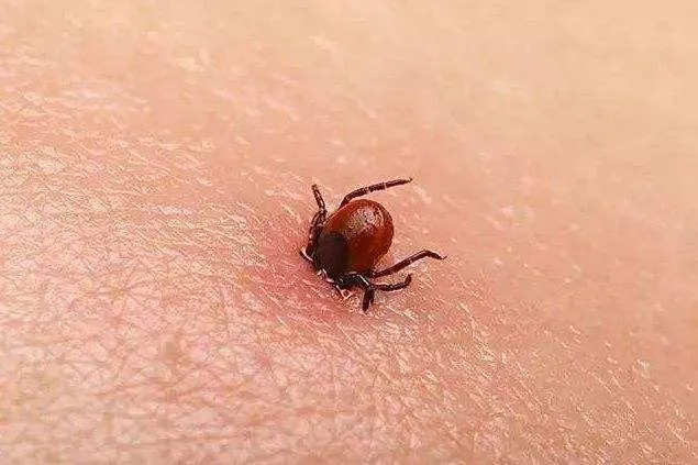 最近高发！新型病毒导致高热、出血，危重症死亡率高达70%！已有人中招！