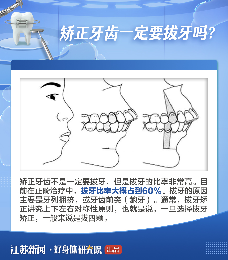 你与变美只差一个牙套的距离！牙齿矫正这8件事你一定要知道