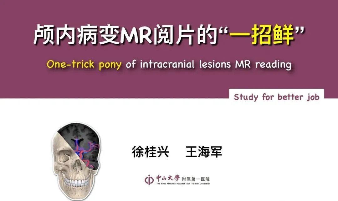 最全影像总结 | 颅内病变 MR、CT 的阅片技巧，太赞了