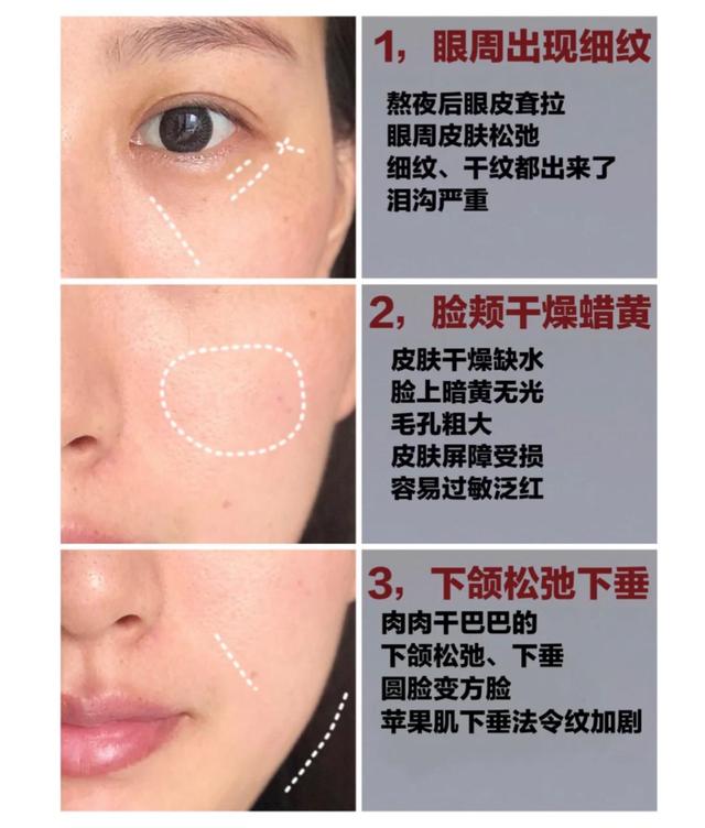 面膜多久敷一次才好？難怪護膚品不吸收，皮膚還是干燥起皮