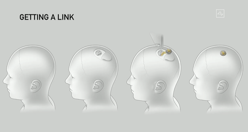 “科学狂人”马斯克直播遛猪：脑机接口是魔法还是反人类？